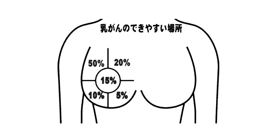早期発見のチェック項目